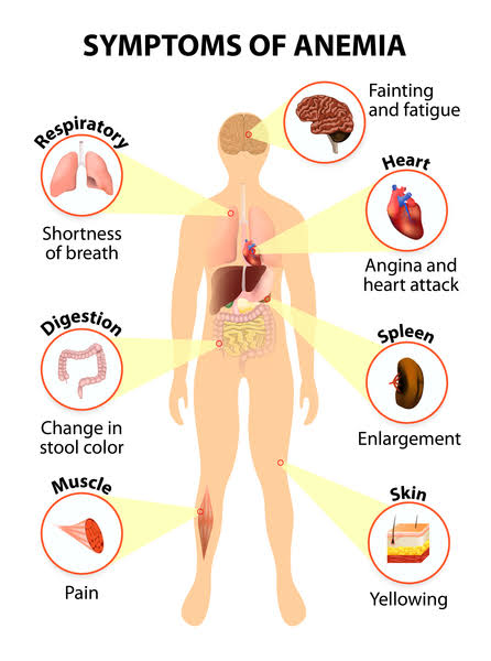 iron deficiency